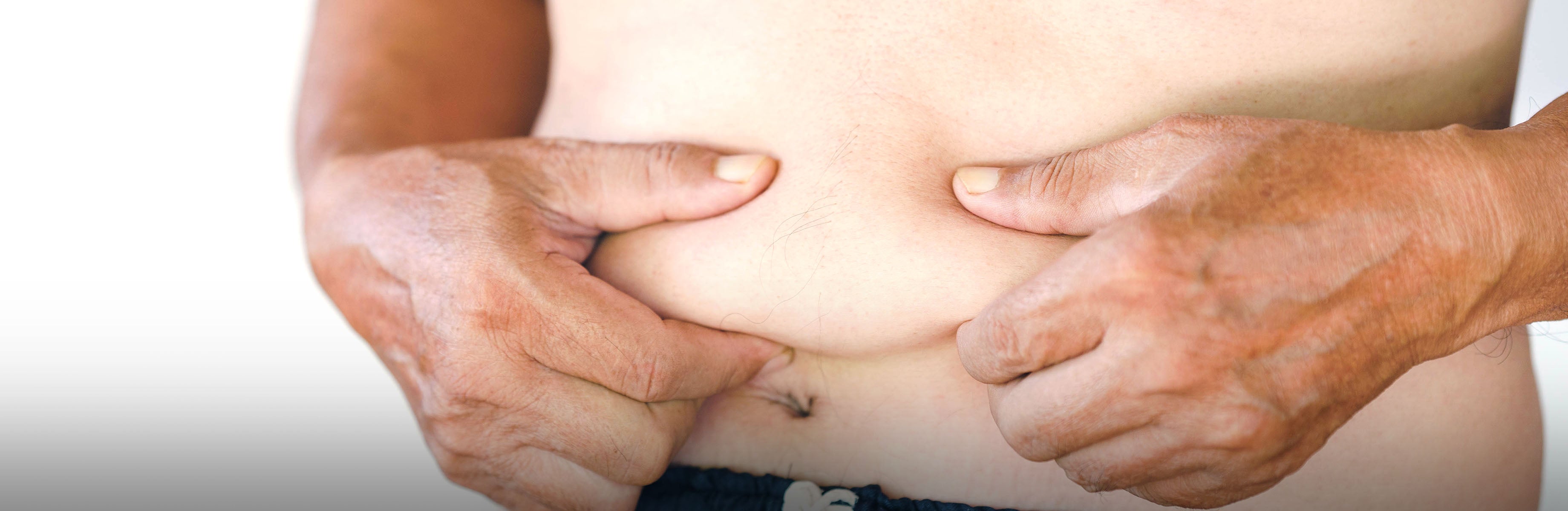 Person hält eine Bauchfalte zwischen den Händen